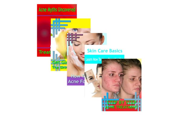 Collezione Beating Acne 5 Guides