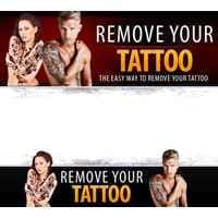 Modello di rimozione del tatuaggio