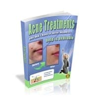 Trattamenti di acne!