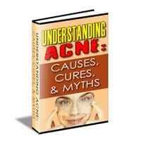 Comprensione dell'acne